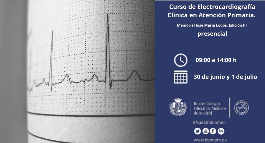 Curso De Electrocardiografía Clínica En Atención Primaria. Memorial ...